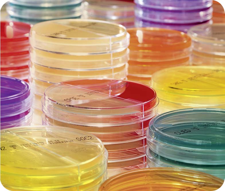 Production of ready‑to‑use Culture media plates