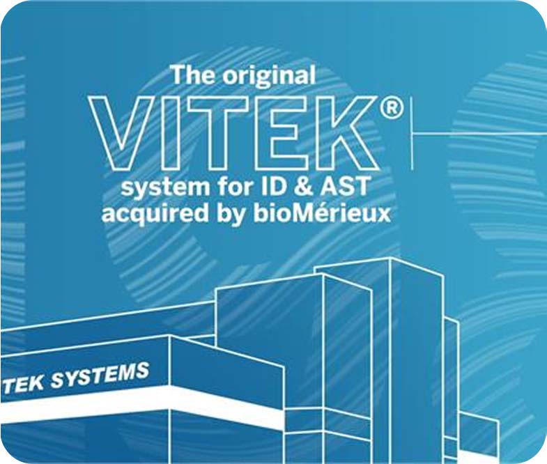 Blueprint of the first VITEK system